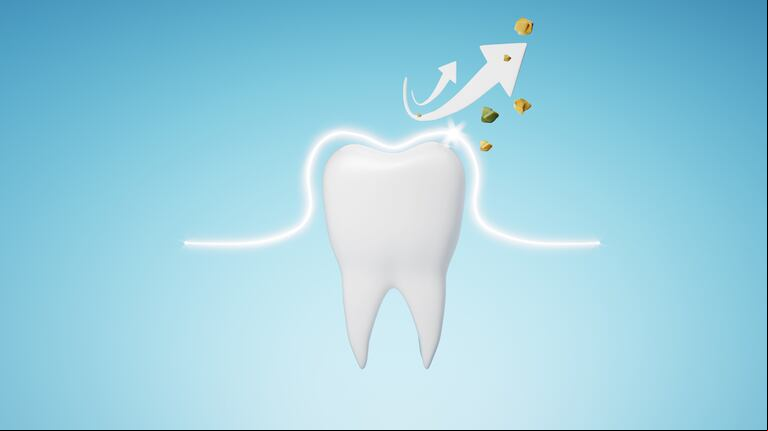 Cómo hay que lavarse los dientes para no tener caries. (Foto AdobeStock)