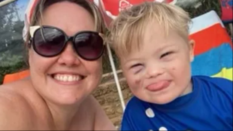 Después de unas vacaciones, Charlotte notó que su hijo tenía unas extrañas manchas en el cuerpo. (Foto: The Sun)