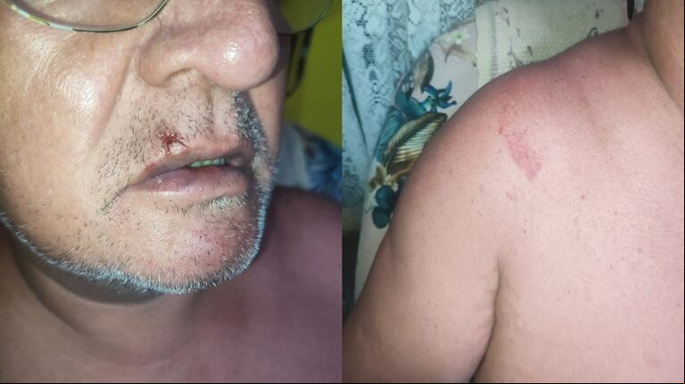 El bañista denunció que recibió patadas en la cabeza, golpes en la cara y en la espalda (Fotos: TN).