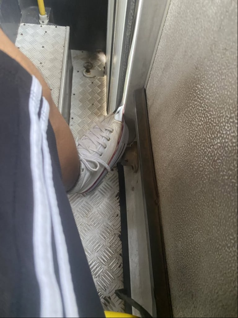 El tuitero compartió una foto para mostrar lo que le había pasado. (Foto: X/@stollendance)