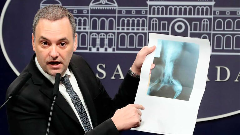 El vocero presidencial Manuel Adorni expuso la radiografía de un perro como una de las irregularidades que se detectó en un expediente. (Foto: Oficina de Presidencia).