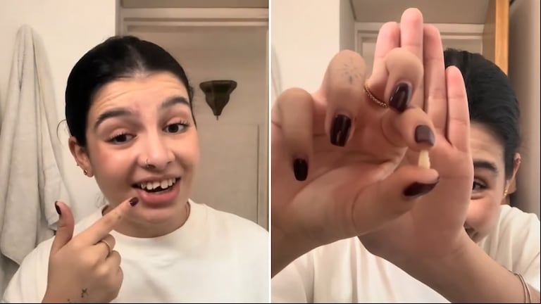 Una joven se rompió un diente y tomó una drástica decisión para arreglarlo “rápido”: “Tutoriales para vivir”