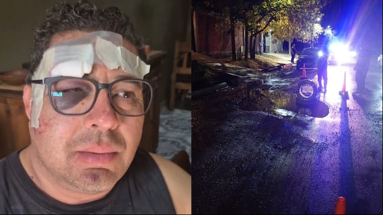 Conmoción en Mendoza: un motociclista se cayó en un pozo, quedó inconsciente y lo dieron por muerto