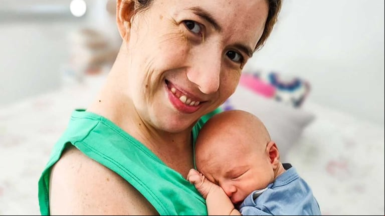 Mujeres y discapacidad: rompiendo prejuicios en la maternidad