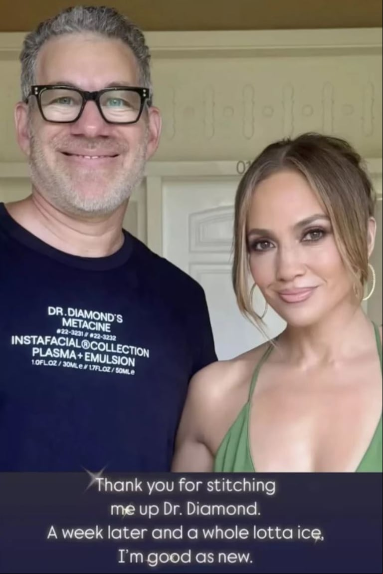 Jennifer López quedó "como nueva", gracias a su médico cirujano, quien la atendió tras su accidente. (Foto: Instagram / jlo)