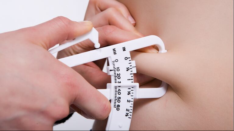 Los científicos deberán realizar un seguimiento de las personas para determinar si la grasa corporal provoca una disminución de materia gris o viceversa. (Foto: Shutterstock)