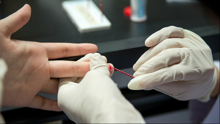 Los insumos son necesarios para realizar todos los controles periódicos (Foto: Shutterstock).