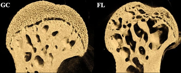 Los investigadores centraron su estudio en los fémures, que en los ratones tienen la función de soporte del peso corporal. (Foto: Plos One)