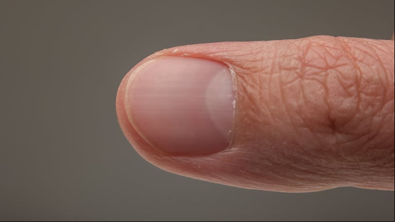 ¿Qué significa tener las uñas con rayas? (Foto: Adobe Stock).